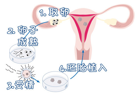 林教授